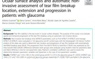 Analyse der Augenoberfläche und nicht-invasive Bewertung des Tränenfilmabrisses (BUT) bei Glaukompatienten.